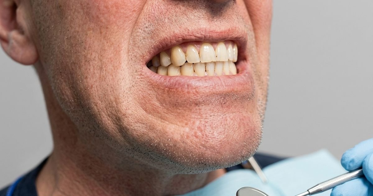 Bruxismo y armonización orofacial en Oralmaax, foto 2