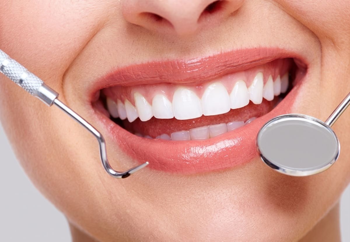 Diseño de sonrisa en Oralmaax, foto 2