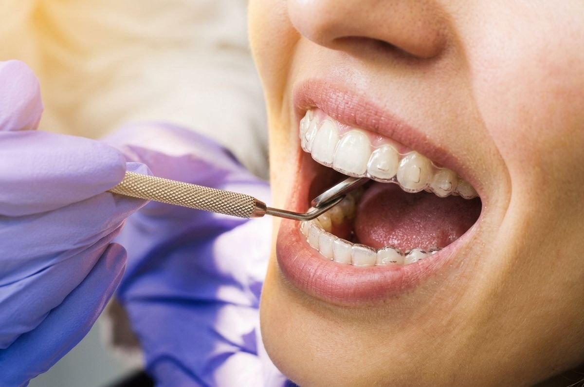 Ortodoncia en Oralmaax, foto 2