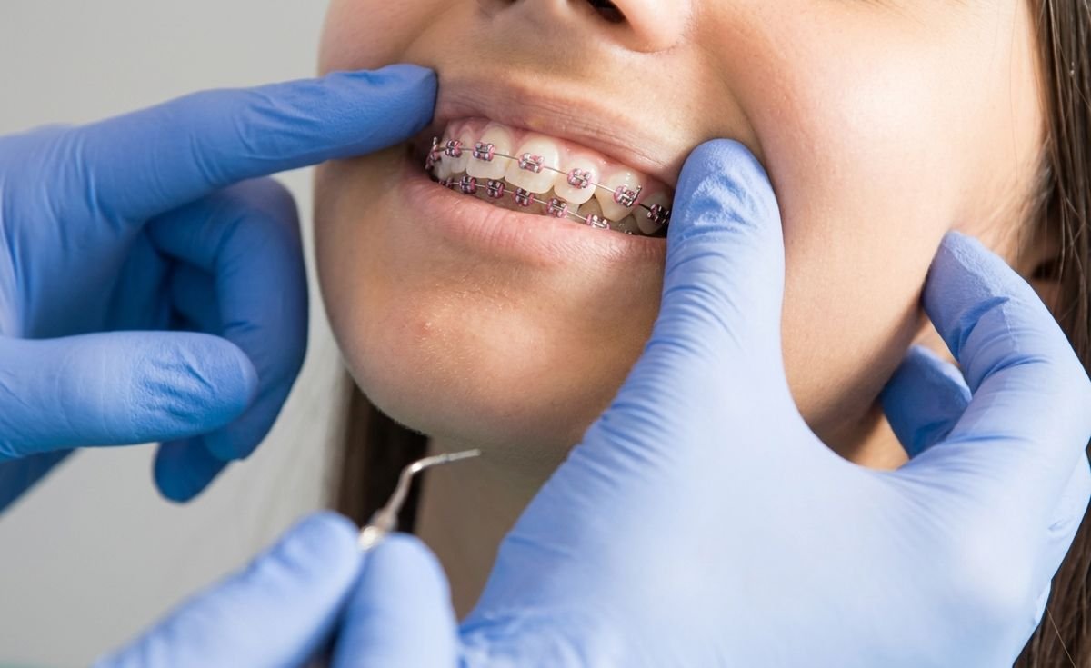 Ortodoncia en Oralmaax, foto 4